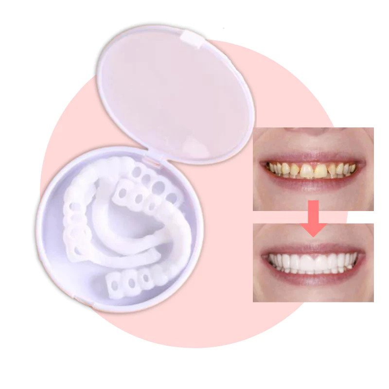Snap-On Veneers | Flexible No-Glue Fit for Meals and Daily Wear 3