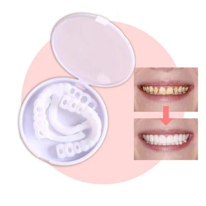 Snap-On Veneers | Flexible No-Glue Fit for Meals and Daily Wear 3